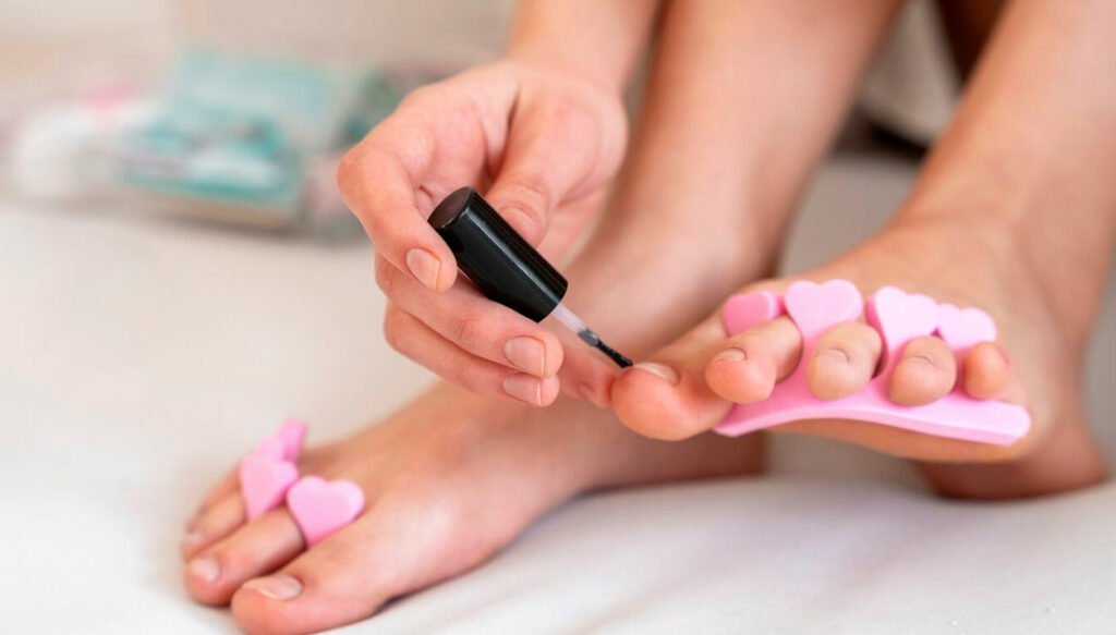 El uso de esmaltes convencionales para "ocultar" el problema